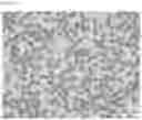 Fig. 12 - COMPOSITIONS OF DISPERSED PHASE FOR PREPARATION OF APIXABAN-LOADED MICROSPHERES AND BIOCOMPATIBLE POLYMER-BASED APIXABAN-LOADED MICROSPHERES PREPARED THEREFROM
