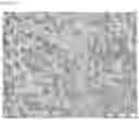 Fig. 14 - COMPOSITIONS OF DISPERSED PHASE FOR PREPARATION OF APIXABAN-LOADED MICROSPHERES AND BIOCOMPATIBLE POLYMER-BASED APIXABAN-LOADED MICROSPHERES PREPARED THEREFROM