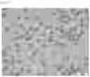 Fig. 15 - COMPOSITIONS OF DISPERSED PHASE FOR PREPARATION OF APIXABAN-LOADED MICROSPHERES AND BIOCOMPATIBLE POLYMER-BASED APIXABAN-LOADED MICROSPHERES PREPARED THEREFROM