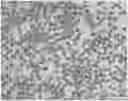 Fig. 01 - METHOD FOR PREPARING BIOCOMPATIBLE POLYMER-BASED APIXABAN-LOADED MICROSPHERES