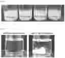Fig. 02 - METHOD FOR PREPARING BIOCOMPATIBLE POLYMER-BASED APIXABAN-LOADED MICROSPHERES