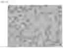 Fig. 08 - METHOD FOR PREPARING BIOCOMPATIBLE POLYMER-BASED APIXABAN-LOADED MICROSPHERES