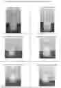 Fig. 02 - TOPICAL DAPSONE AND DAPSONE/ADAPALENE COMPOSITIONS AND METHODS FOR USE THEREOF