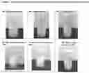 Fig. 04 - TOPICAL DAPSONE AND DAPSONE/ADAPALENE COMPOSITIONS AND METHODS FOR USE THEREOF
