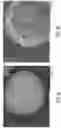 Fig. 02 - FORMULATIONS OF L-ORNITHINE PHENYLACETATE