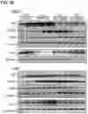 Fig. 15 - Methods of treating HIV-associated neurological disorders (HAND)