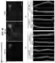 Fig. 24 - Methods of treating HIV-associated neurological disorders (HAND)
