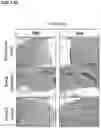 Fig. 40 - Methods of treating HIV-associated neurological disorders (HAND)