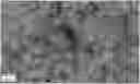 Fig. 01 - PROCESS FOR PREPARING SPHERICAL AGGLOMERATES OF TIMAPIPRANT