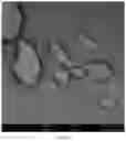Fig. 06 - PROCESS FOR PREPARING SPHERICAL AGGLOMERATES OF TIMAPIPRANT