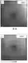 Fig. 06 - COMPOSITIONS AND METHODS FOR TREATING AGE-RELATED MACULAR DEGENERATION