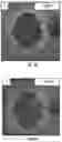 Fig. 07 - COMPOSITIONS AND METHODS FOR TREATING AGE-RELATED MACULAR DEGENERATION