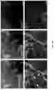 Fig. 11 - COMPOSITIONS AND METHODS FOR THE TREATMENT OF ABERRANT ANGIOGENESIS