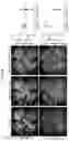 Fig. 13 - COMPOSITIONS AND METHODS FOR THE TREATMENT OF ABERRANT ANGIOGENESIS