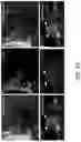Fig. 34 - COMPOSITIONS AND METHODS FOR THE TREATMENT OF ABERRANT ANGIOGENESIS