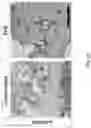 Fig. 36 - COMPOSITIONS AND METHODS FOR THE TREATMENT OF ABERRANT ANGIOGENESIS