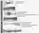 Fig. 01 - ESOPHAGEAL STRICTURE SUPPRESSING AGENT