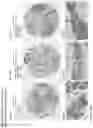 Fig. 149 - ANTI-VARIABLE MUC1* ANTIBODIES AND USES THEREOF