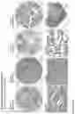 Fig. 160 - ANTI-VARIABLE MUC1* ANTIBODIES AND USES THEREOF