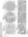 Fig. 167 - ANTI-VARIABLE MUC1* ANTIBODIES AND USES THEREOF