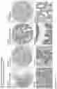 Fig. 189 - ANTI-VARIABLE MUC1* ANTIBODIES AND USES THEREOF