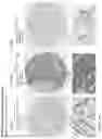 Fig. 201 - ANTI-VARIABLE MUC1* ANTIBODIES AND USES THEREOF