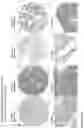 Fig. 214 - ANTI-VARIABLE MUC1* ANTIBODIES AND USES THEREOF