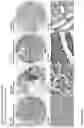 Fig. 227 - ANTI-VARIABLE MUC1* ANTIBODIES AND USES THEREOF