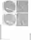 Fig. 247 - ANTI-VARIABLE MUC1* ANTIBODIES AND USES THEREOF