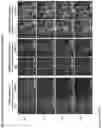 Fig. 257 - ANTI-VARIABLE MUC1* ANTIBODIES AND USES THEREOF