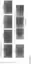Fig. 47 - ANTI-VARIABLE MUC1* ANTIBODIES AND USES THEREOF