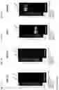 Fig. 78 - ANTI-VARIABLE MUC1* ANTIBODIES AND USES THEREOF