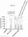 Fig. 07 - S309 chimeric antigen receptors and methods of use