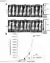 Fig. 19 - METHOD FOR PRODUCING CAR GENE-INTRODUCED NK CELLS AND USE THEREOF