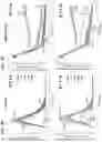 Fig. 12 - CELLS EXPRESSING A RECOMBINANT RECEPTOR FROM A MODIFIED TGFBR2 LOCUS, RELATED POLYNUCLEOTIDES AND METHODS