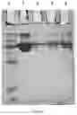 Fig. 03 - Platelet lysate, and method of preparation thereof