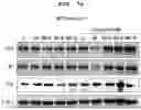 Fig. 08 - PHARMACEUTICAL COMPOSITION FOR PREVENTING OR TREATING LIVER DISEASE,  COMPRISING BIOIMPLANT COMPRISING MESENCHYMAL STEM CELLS