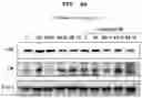 Fig. 12 - PHARMACEUTICAL COMPOSITION FOR PREVENTING OR TREATING LIVER DISEASE,  COMPRISING BIOIMPLANT COMPRISING MESENCHYMAL STEM CELLS