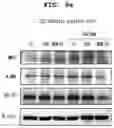 Fig. 15 - PHARMACEUTICAL COMPOSITION FOR PREVENTING OR TREATING LIVER DISEASE,  COMPRISING BIOIMPLANT COMPRISING MESENCHYMAL STEM CELLS
