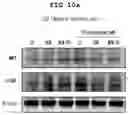 Fig. 19 - PHARMACEUTICAL COMPOSITION FOR PREVENTING OR TREATING LIVER DISEASE,  COMPRISING BIOIMPLANT COMPRISING MESENCHYMAL STEM CELLS