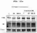 Fig. 22 - PHARMACEUTICAL COMPOSITION FOR PREVENTING OR TREATING LIVER DISEASE,  COMPRISING BIOIMPLANT COMPRISING MESENCHYMAL STEM CELLS