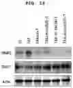 Fig. 32 - PHARMACEUTICAL COMPOSITION FOR PREVENTING OR TREATING LIVER DISEASE,  COMPRISING BIOIMPLANT COMPRISING MESENCHYMAL STEM CELLS