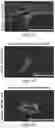 Fig. 05 - HIGHLY FUNCTIONAL MANUFACTURED ABCB5+ MESENCHYMAL STEM CELLS