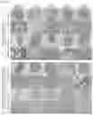 Fig. 10 - DIFFERENTIATION INDUCER CONTAINING NUCLEUS PULPOSUS CELL MASTER REGULATOR TRANSCRIPTION FACTORS, METHOD FOR PRODUCING INDUCED NUCLEUS PULPOSUS CELLS, AND USE OF INDUCED NUCLEUS PULPOSUS CELLS