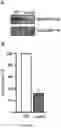 Fig. 11 - COMPOSITIONS AND METHODS OF MODULATING CASOTRANSMITTER SIGNALING