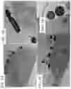 Fig. 11 - MEDICINAL VAGINAL LACTOBACILLUS COCKTAIL
