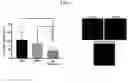 Fig. 05 - METHODS OF OCULAR TREATMENT USING AN ENGINEERED DIMERIC FRAGMENT OF HEPATOCYTE GROWTH FACTOR