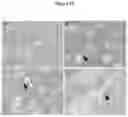 Fig. 17 - A Composition for the Delivery of Biologically Active Agents and Uses Thereof