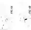 Fig. 06 - IMMUNOGENIC COMPOSITION FORMING A VACCINE, AND A METHOD FOR ITS MANUFACTURE