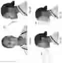 Fig. 08 - Protective respirator utilizing far UV-C irradiation
